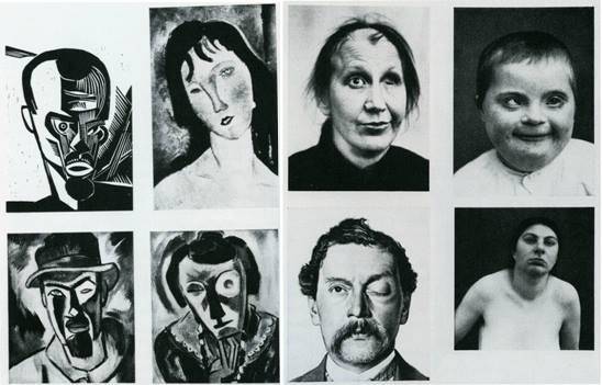 Pour preuve il y reproduit des exemples d'art moderne (ici le peintre expressionniste allemand Karl Schmidt-Rottluff et Amedeo Modigliani) à côté de photographies de personnes avec des difformités et des maladies, renforçant graphiquement l'idée de modernité en tant que maladie.